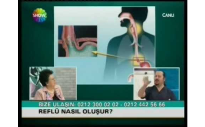 Reflü tedavisi,Prof. Dr. Erhun Eyüboğlu,Reflü Cerrahisi,Erhun Eyüboğlu
