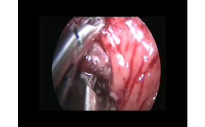 TEM Yöntemi,Prof. Dr. Erhun Eyüboğlu,TEM Yöntemi videoları