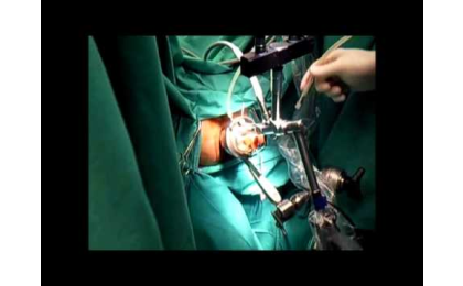 tem-sistemi-kurulumu-prof-dr-erhun-eyuboglu