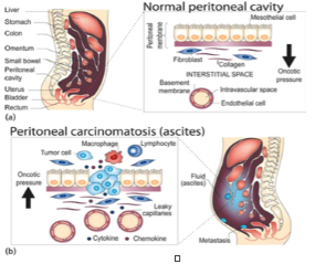 Pipac Nasıl Yapılır?